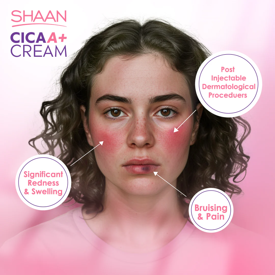 Shaan CICA ARNICA+ cream 40gm - Image 3