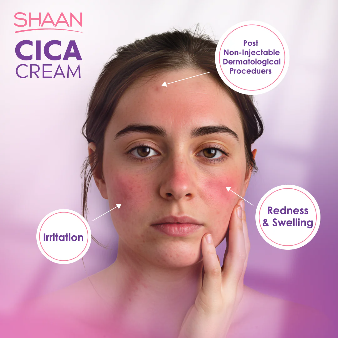 Shaan CICA cream 60 ml - Image 3