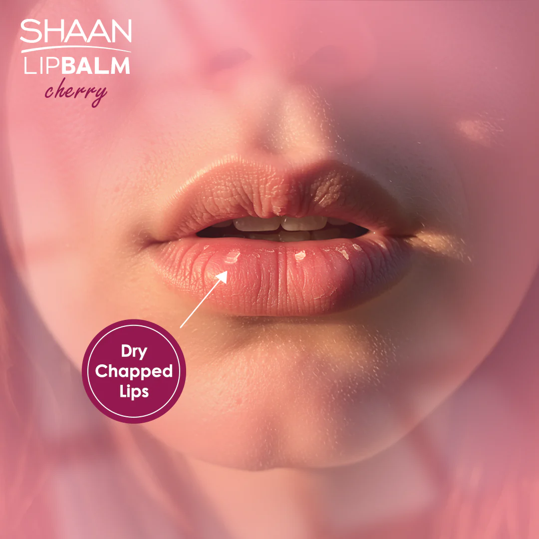 Shaan Lip Balm Cherry 5 gm - Image 3